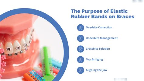 Purpose Of Elastic Bands