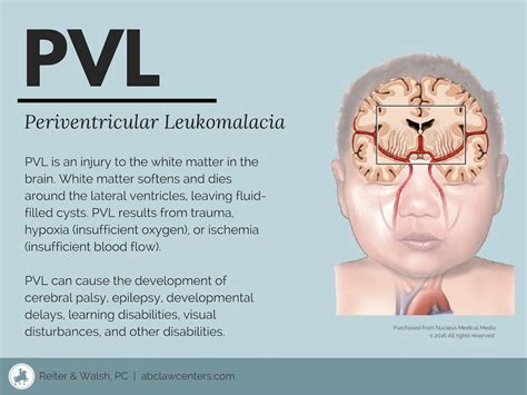 pvl medical abbreviation