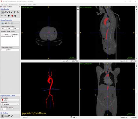 Python Medical Image Viewer