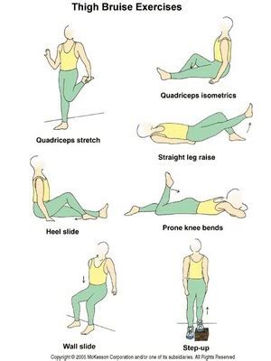 Quad Contusion Exercises