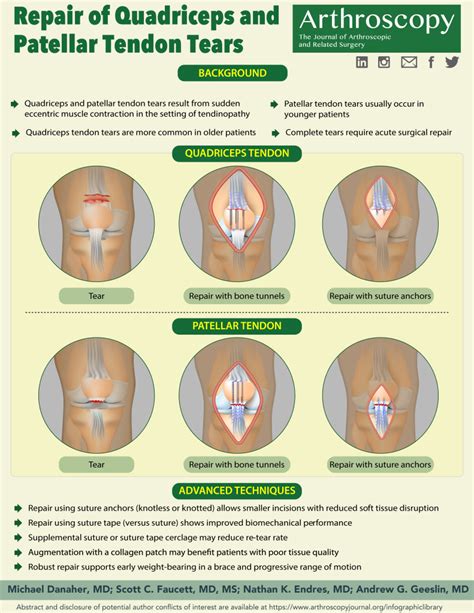 quad tendon repair cpt code