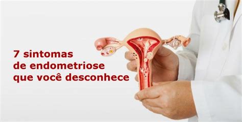 quais os sintomas de endometriose