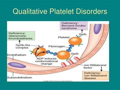 Understanding Qualitative Disorders Of Platelets In Clinical Practice