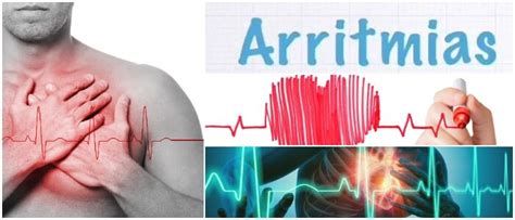 que es arritmia sinusal