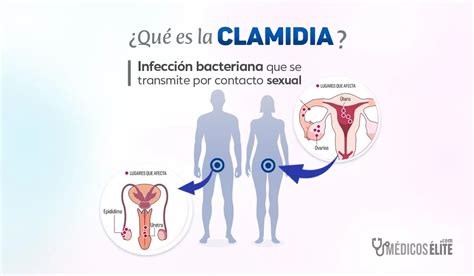 Que es Clamidia: Conozca los Riesgos y Síntomas Ocultos