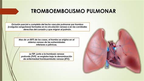 que es el embolismo pulmonar