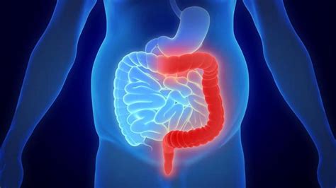 Entendiendo la Colitis: Causas, Síntomas y Tratamientos Disponibles