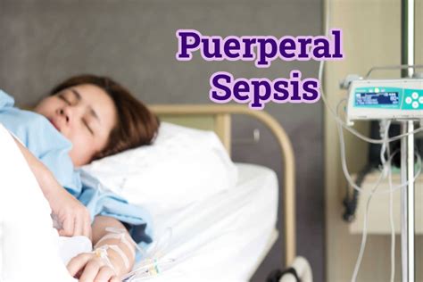 que es la sepsis puerperal