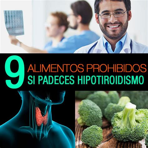 Que No Comer Con Hipotiroidismo