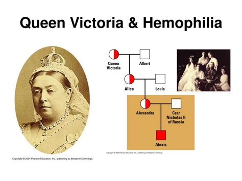 queen victoria hemophilia