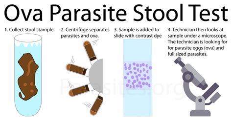 quest ova and parasite stool