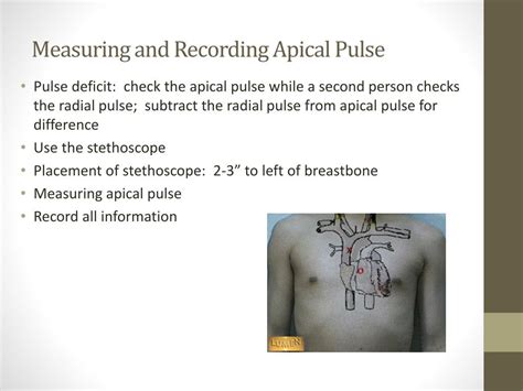 question which example is the correct way to record apical pulse responses
