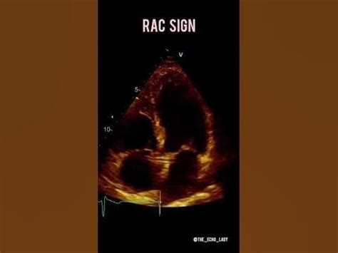 rac sign in online