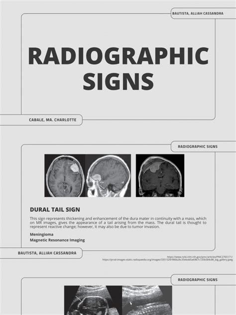 Radiographic Signs