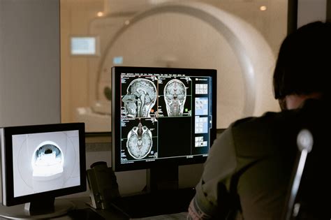 Radiology Imaging Informatics
