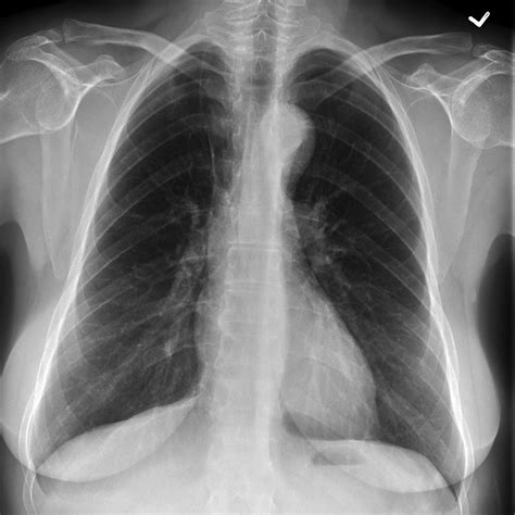 radiopaedia cases