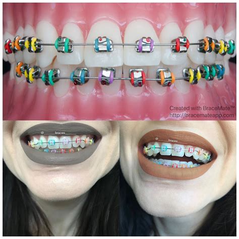 Rainbow Braces