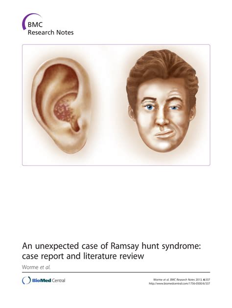 ramsay hunt syndrome review