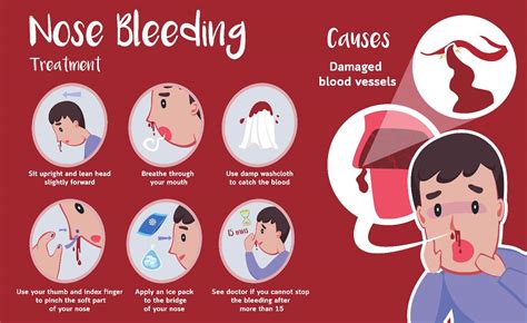 What Causes Random Nose Bleeds and How to Stop Them