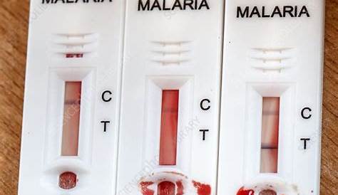 Malaria progress stalls, new report says ABC News