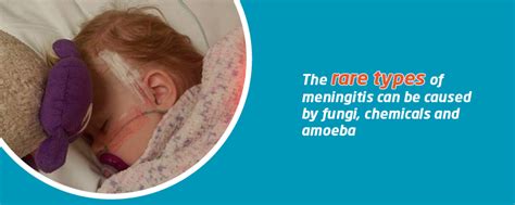 rare meningitis types