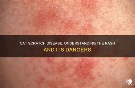 Rash After Cat Bite
