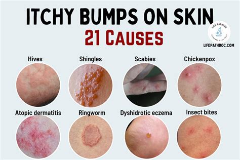 Rash Itchy Spots