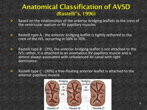 rastelli type avsd