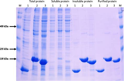 Recombinant Protein Expression And Analysis By Sds Page