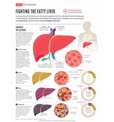 recovery from fatty liver disease