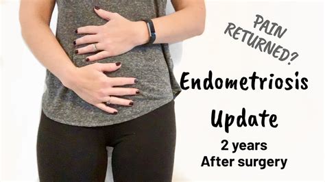 recovery time after endometriosis surgery