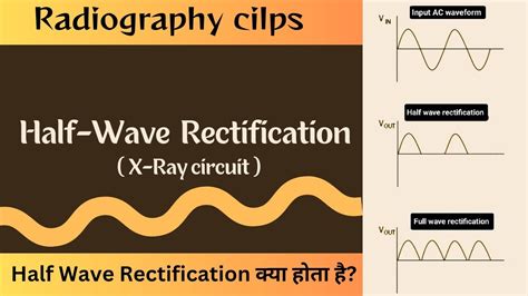 Rectification In Xray