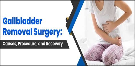 Recovering with Ease: A Comprehensive Guide to Smooth Recuperation from Gallbladder Removal