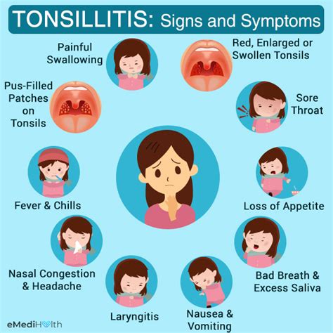 recurrent tonsillitis in toddlers