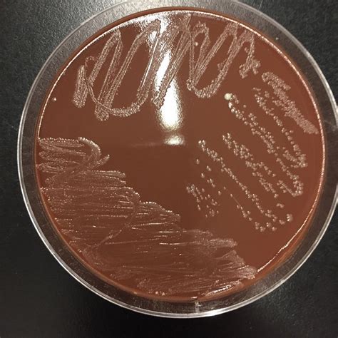 red colonies on chocolate agar