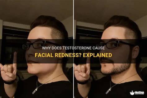 Red Face Caused By Testosterone
