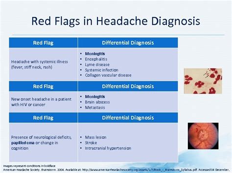 Red Flags For Headaches Nice