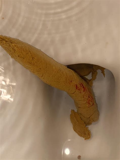 Red Strings In Poop Reddit