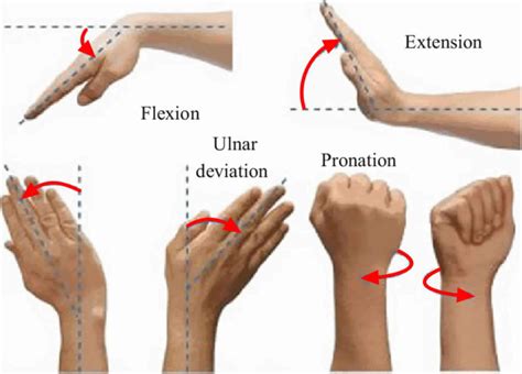 Reduced range of motion in wrist injury
