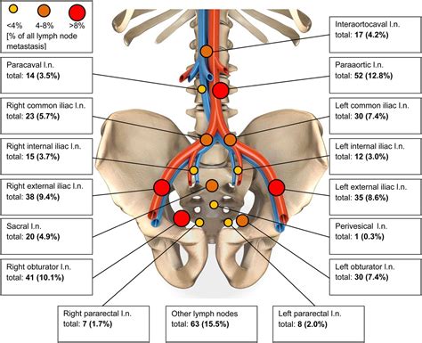 regional lymph nodes of prostate