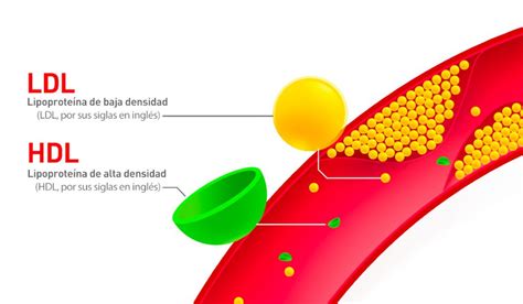 relacion colesterol ldl/colesterol hdl