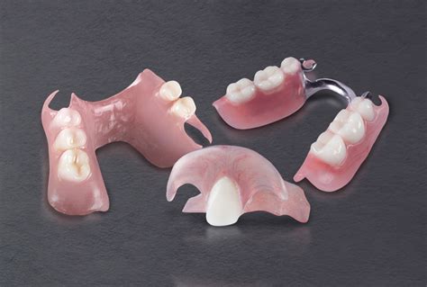 Removable Partial Denture Designs