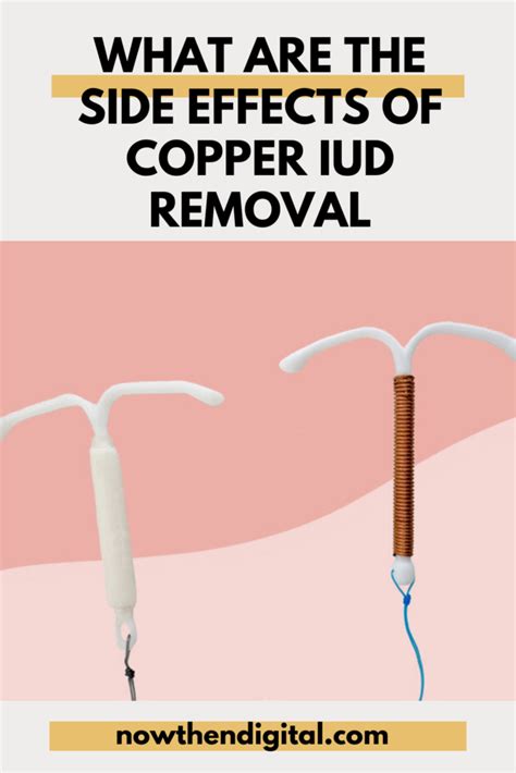 removal of copper iud