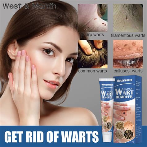 Say Goodbye to Unsightly Growths: Effective Methods for Safe and Painless Removal of HPV Warts