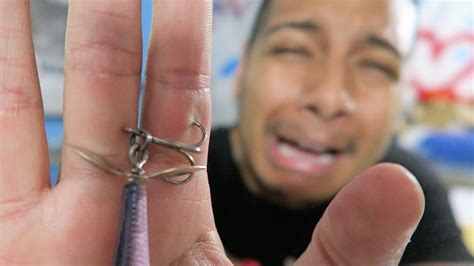 Remove Treble Hook From Skin