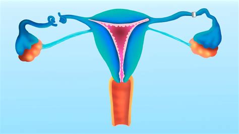 Tubal Ligation: Essential Requirements for Getting Tubes Tied