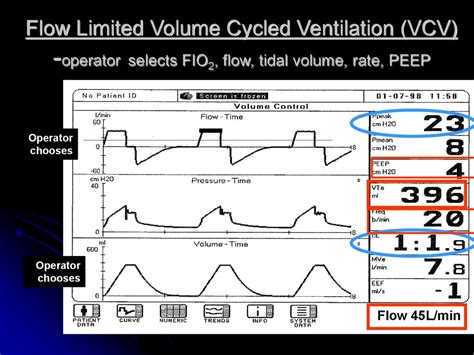 Respiratory Ventilator Flow Rate