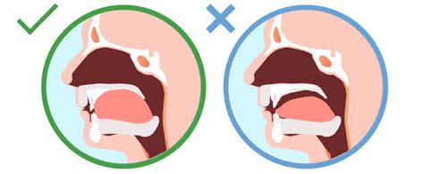 resting position of tongue