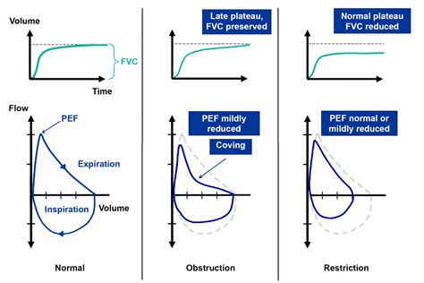Restrictive Spirometry Graph