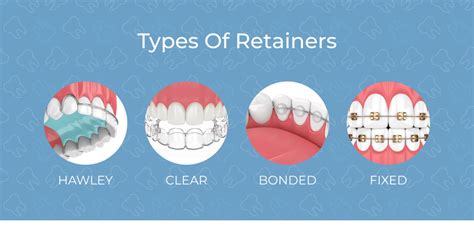 retainer types